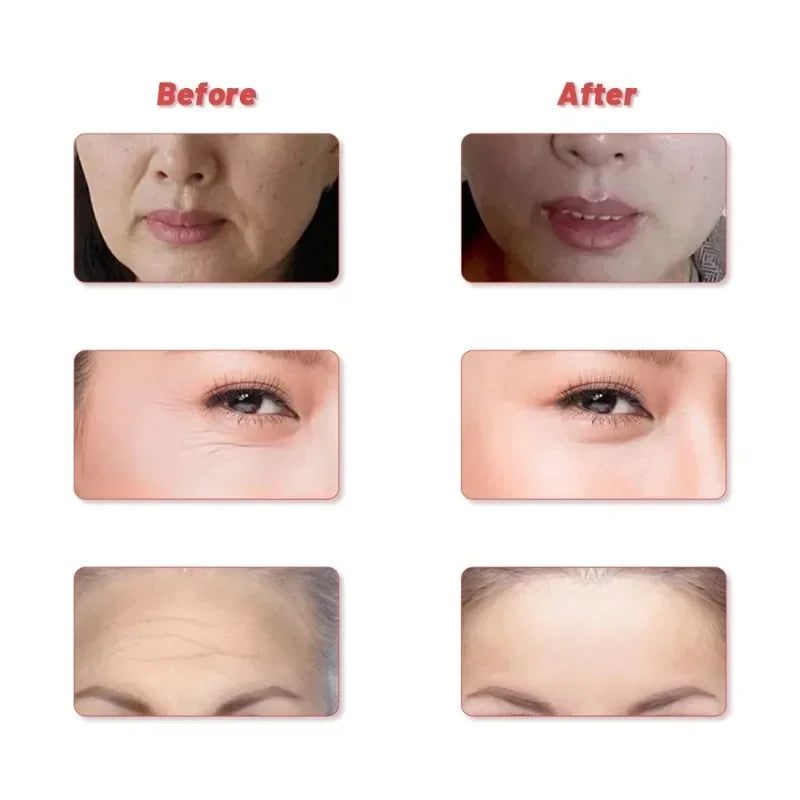 24K Gold Roller Vibrating Facial Massager Slimming Facial Skin Beauty Pulse Firming Face Massage Lift Tightening Wrinkle Bar